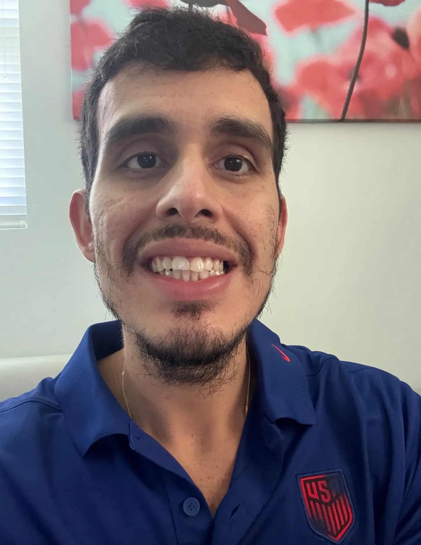 competitor xvjEm